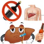 Como reconhecer e tratar a hepatite alcoólica