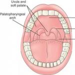 Sintomas e tratamento da inflamação do fundo da garganta Desconforto no fundo da garganta