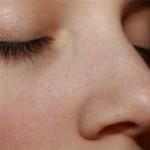 كيفية التخلص من البقع السوداء على الوجه - علاجات مجربة